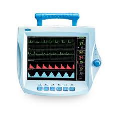 ECG Monitoring